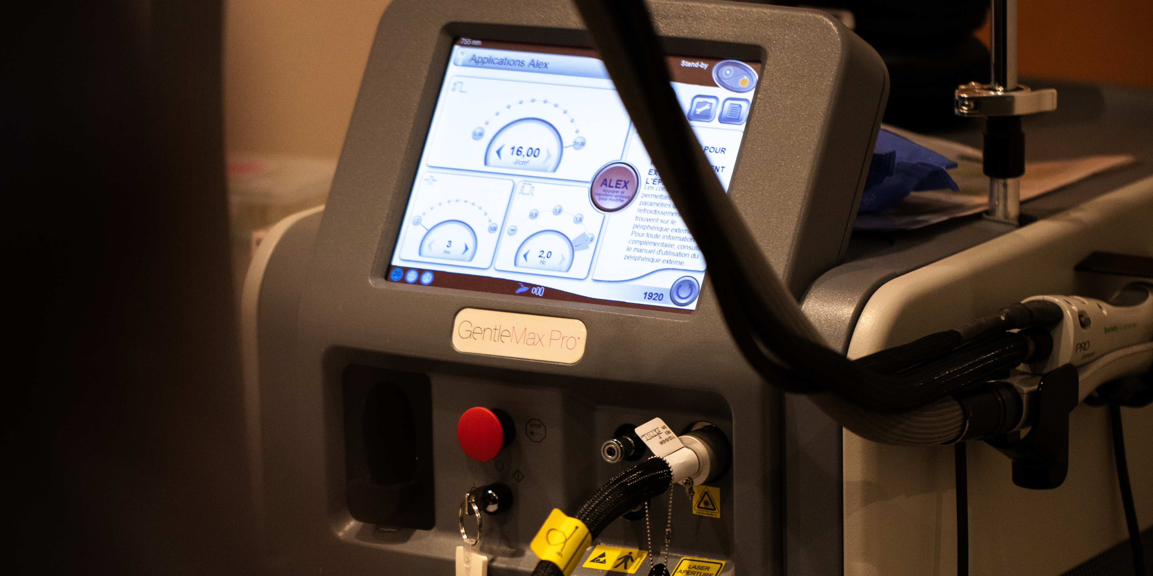 epilation laser 43 perier