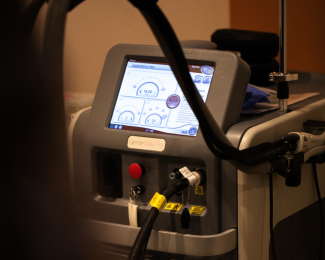 epilation laser 43 perier epilation laser 43 perier