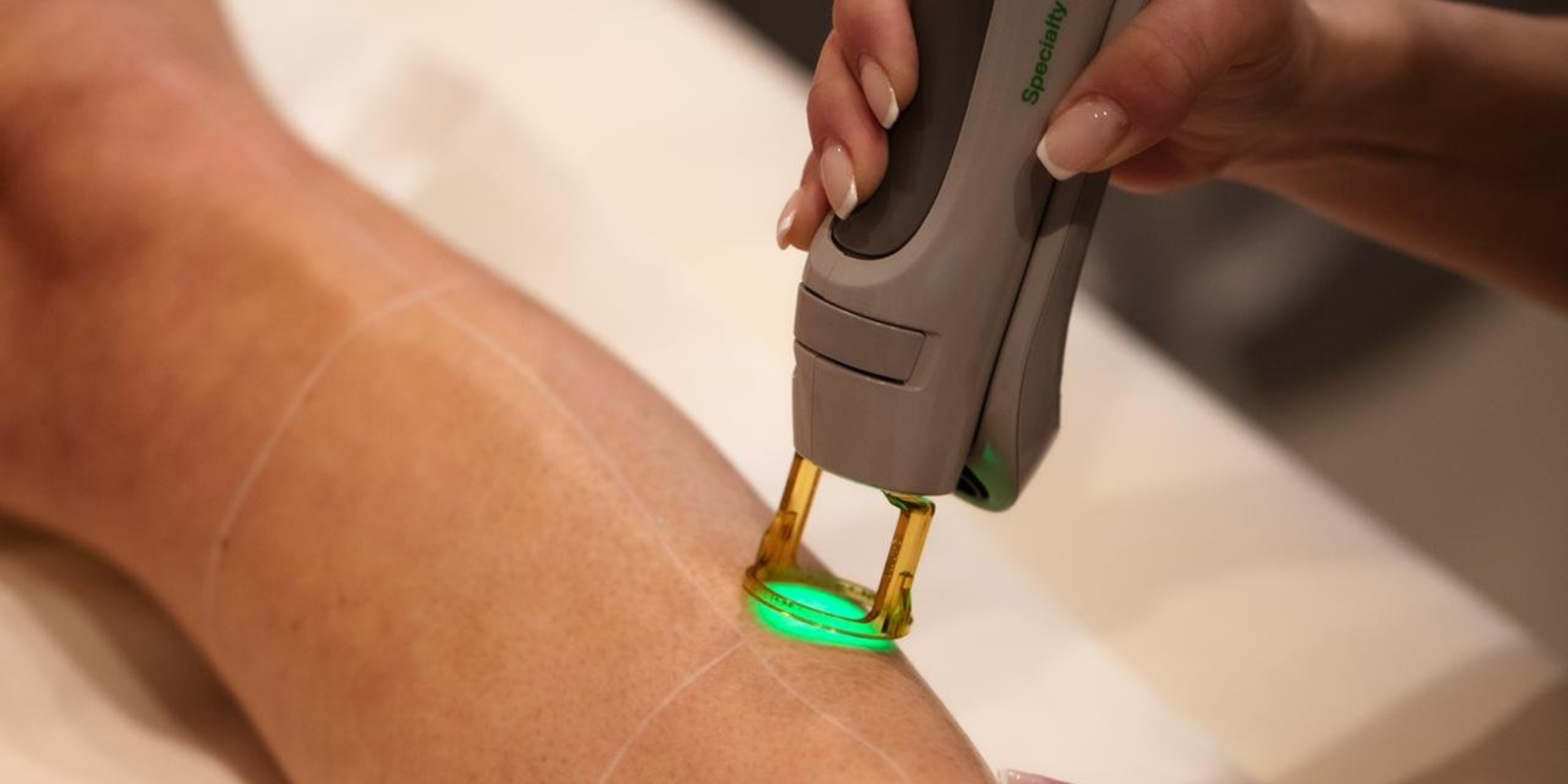 quadrillage-epilation-laser